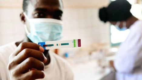 2021 deja 1,5 millones de nuevas infecciones por el VIH, un millón más que el objetivo de 2020