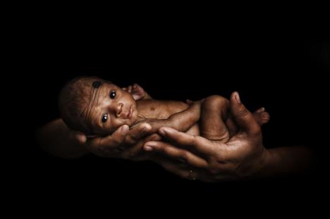 Cerca de 7.000 recién nacidos mueren cada día