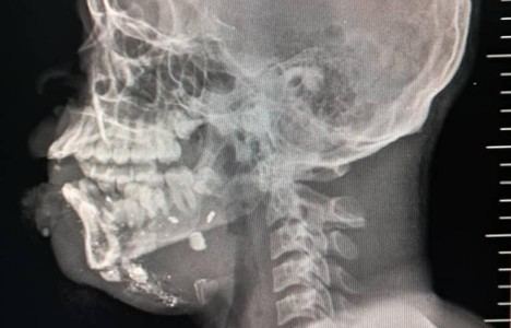 Crisis sanitaria y civil en Haití por aumento de la violencia