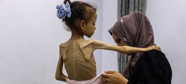 ONU declara hambruna en Gaza y la califica como un crimen de guerra