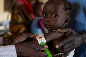 UNICEF alerta sobre la grave desnutrición infantil en Sudán y solicita ayuda urgente