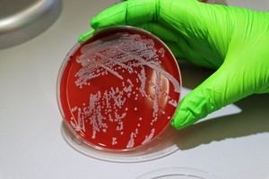Investigadores del CSIC estudian la adaptación del estafilococo a los humanos a gran escala